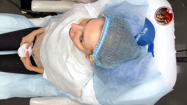 V LIFTING - лифтинг лица