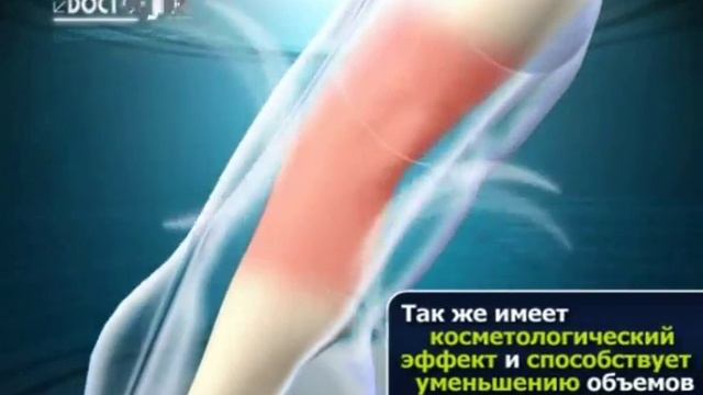 Doctor Life прессотерапия лимфодренаж пневмокомпрессия