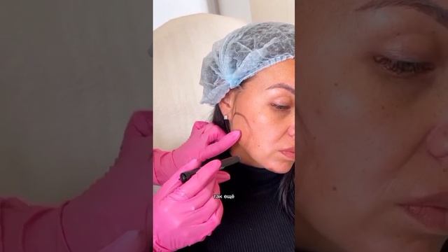 как избавиться от бруксизма. что такое бруксизм