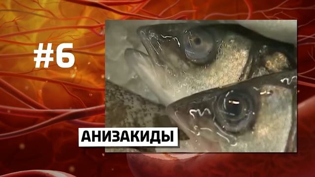 10 Ужасных ПАРАЗИТОВ которые могут жить в тебе