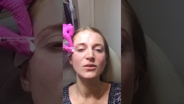 Dr Edgar   Укол БОТОКСа  BOTOX Injection
