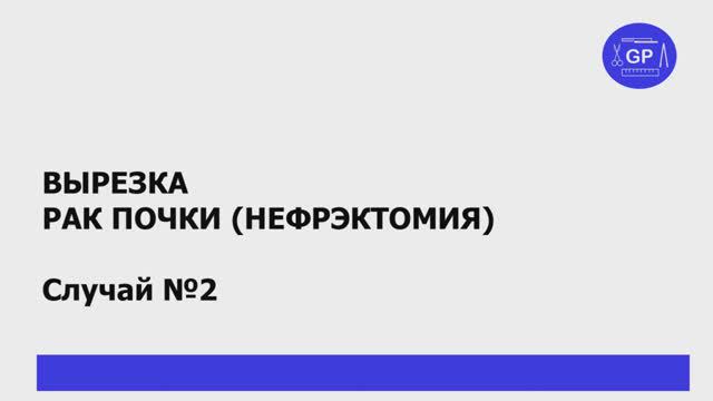 Рак почки (нефрэктомия) - гистологическое исследование (вырезка) - #2