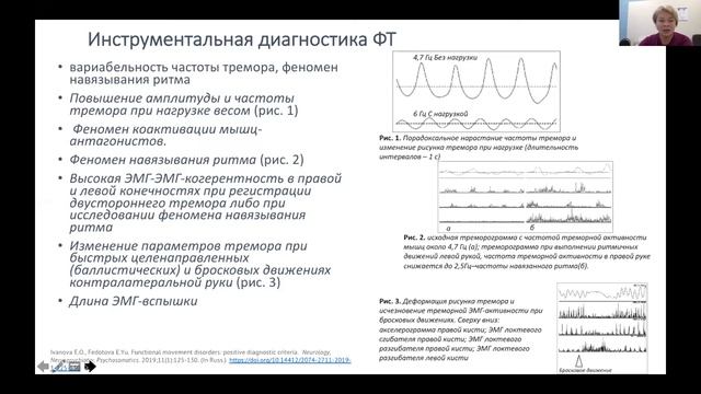 Залялова З. А. Конверсионные дистонии и другие расстройства движения. Как отличить и что делать