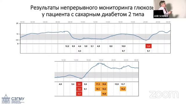 Управляющие параметры сердечно-сосудистого риска у пациентов с диабетом 2 типа.Нелинейный подход.