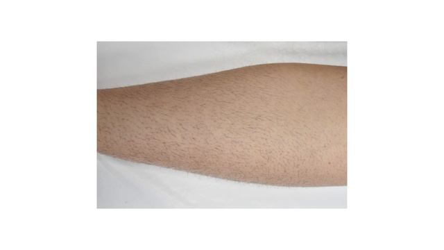 VORTEX EĞİTİM, UYGULAMA VİDEOSU