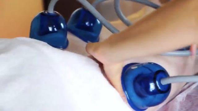 Вакуумно-роликовый массаж