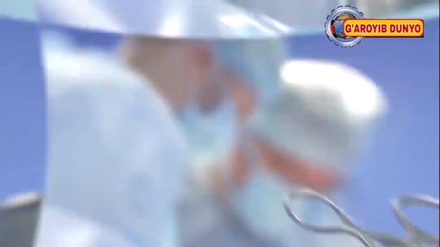 Дунйодаги Энг Ғаройиб Туғилган Болалар дахшат