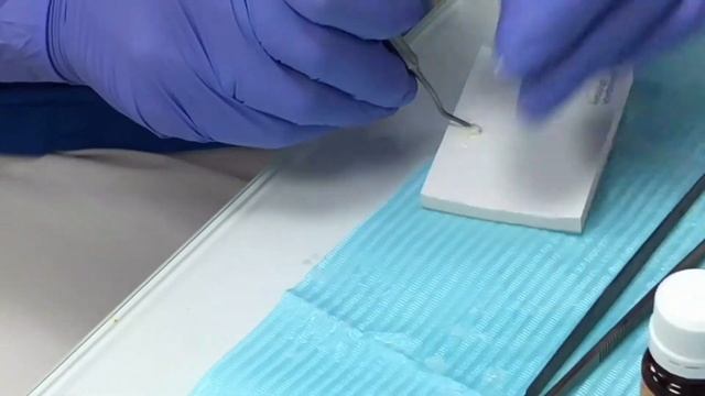 Установка виниров Ӏ Фиксация виниров