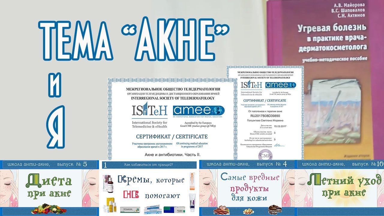 80| Антиакне - современные подходы к лечению (по следам научной конференции 2018 года)