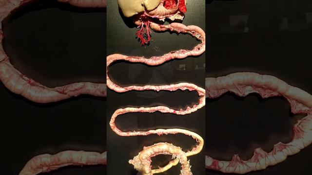 Анатомическая выставка 