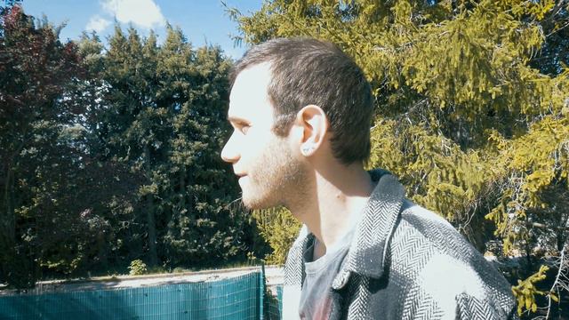 [2ème GREFFE DE CHEVEUX EN TURQUIE - 3 mois après]