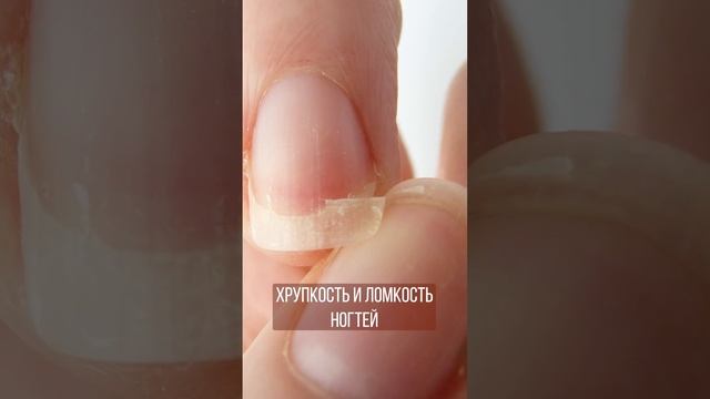 Ставлю диагноз по ногтям