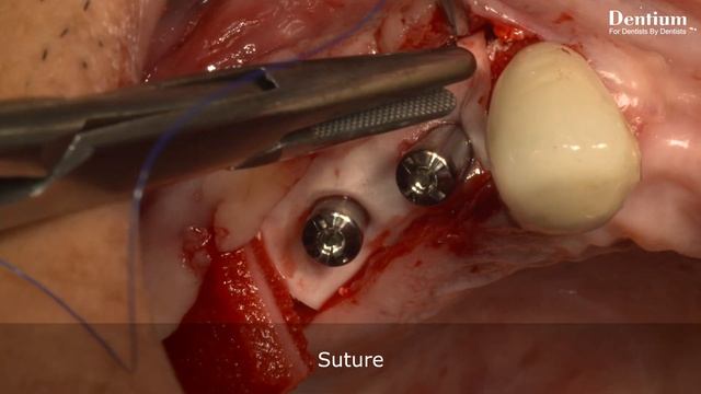 399d485a6fcda58770f1fb03c5c30886