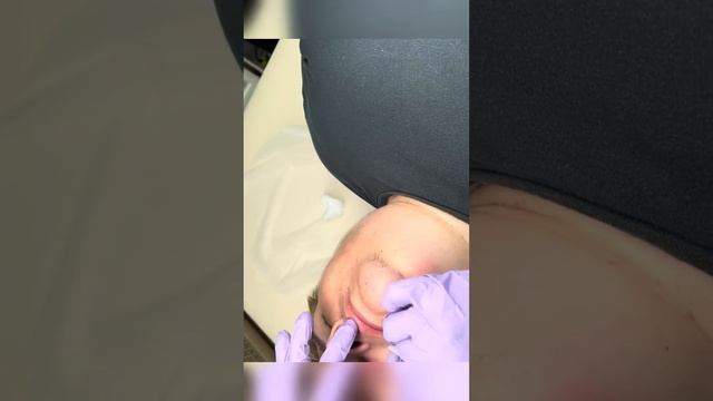 Обучение электроэпиляции онлайн от Трубиной И.Ю.