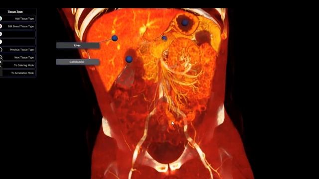 3D Anatomy Learning Software  BodyViz