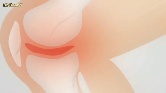 INILAH BEBERAPA MANFAAT LUAR BIASA KACANG MERAH UNTUK KESEHATAN