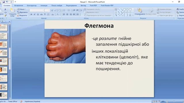 Л5 Хірургічна інфекція