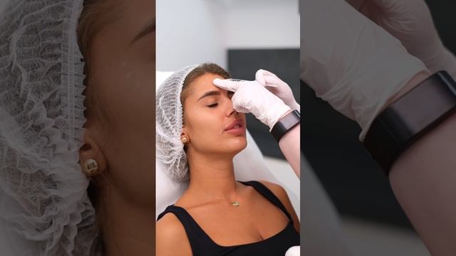 Ін'єкції проти зморшок -