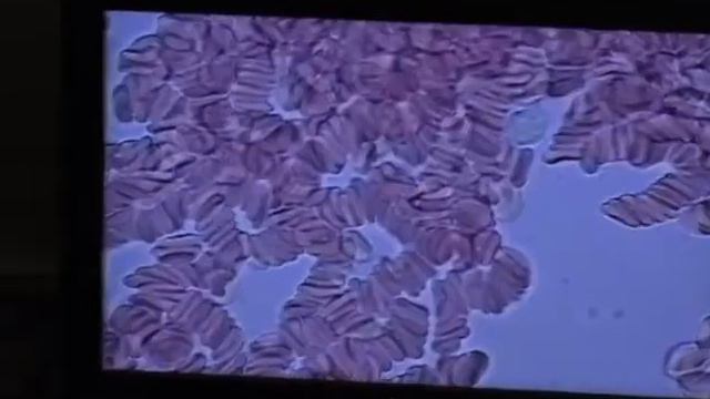Сканирование живой капли крови ч 1 Олег Райхельгауз
