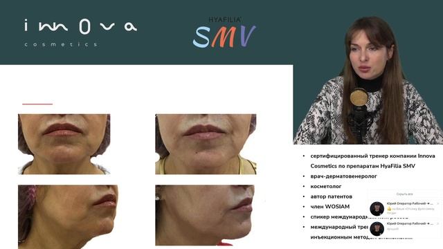 9ce9b2b58eff428ca8eca20d785e7b20