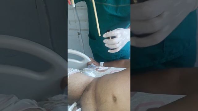 Siydik Pufagiga Katetir Urnatish Tehnikasi