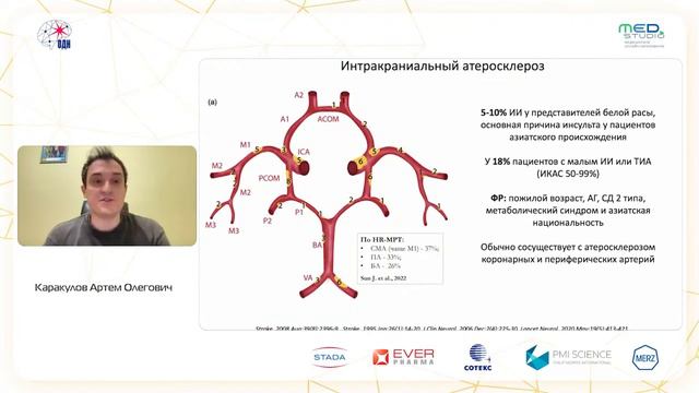 Стеноз интракраниальной артерии: что делать?!. Каракулов А.О.