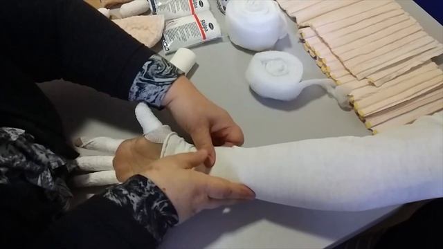 Наложение компрессионного бандажа на руку при лимфедеме