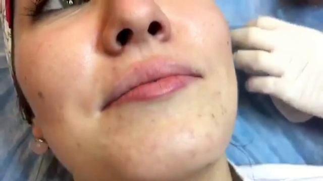 B97d0465e3f2092ef0ab76209d883ba8