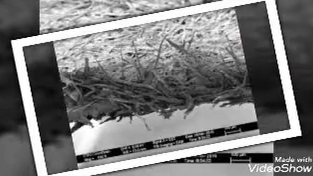Почему порезы от бумаги такие болезненные !?