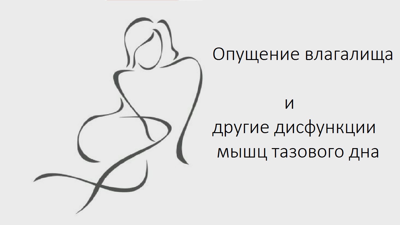 Опущение влагалища и другие дисфункции мышц тазового дна