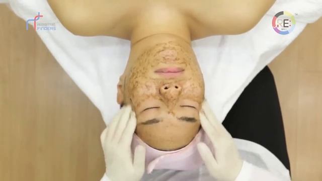 Подтяжка кожи ног