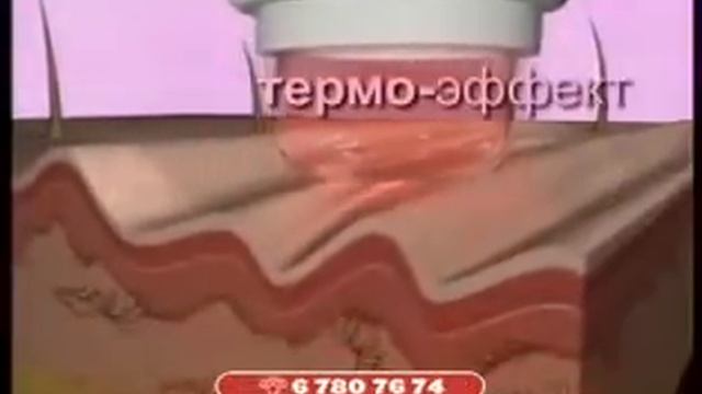 Аппарат для разглаживания морщин   Derma Wand Дерма Ванд