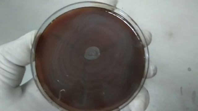 Proteus Swarming Growth And Its Reason Occuring So