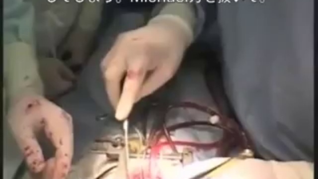 Chernobyl Hart Japanese Title 3.3 