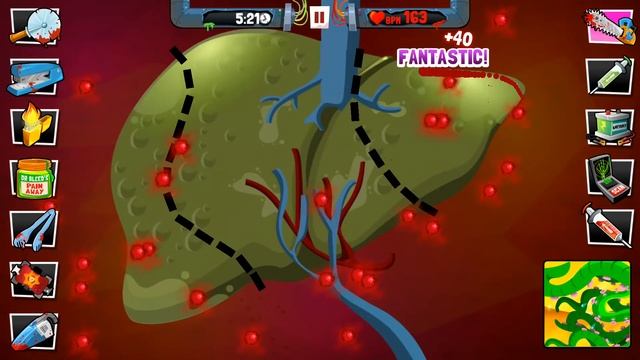 Amateur Surgeon 4 Walkthrough | #33 Killa Bee Killed