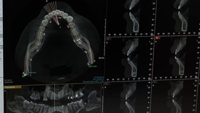 39f38af68b0aa6792ba166ed47c5b4e2