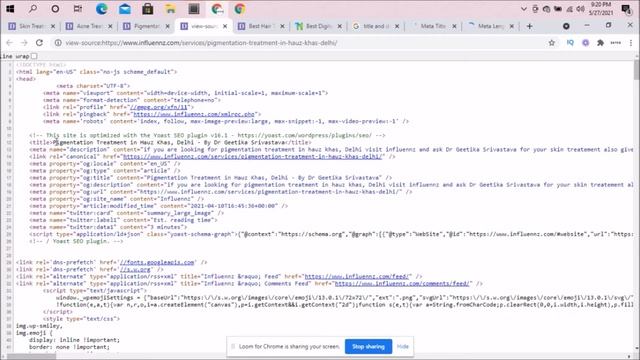 5980a124a21d7743ccf3a83999acbfd4