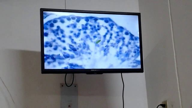 Histologia Sistema Reproductor Masculino Epididimo