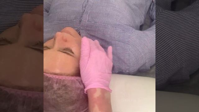 Пилинг PRX-t33