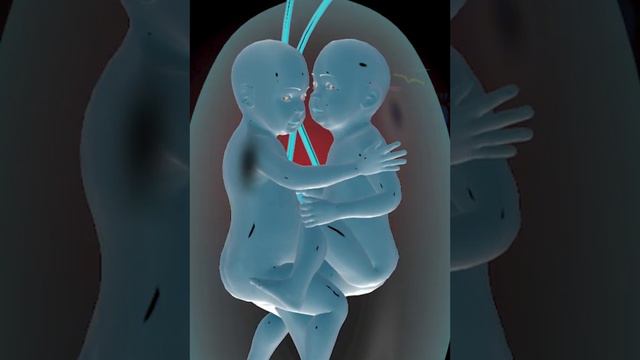 Precious Twins Inside The Womb #education #medical #entertainment