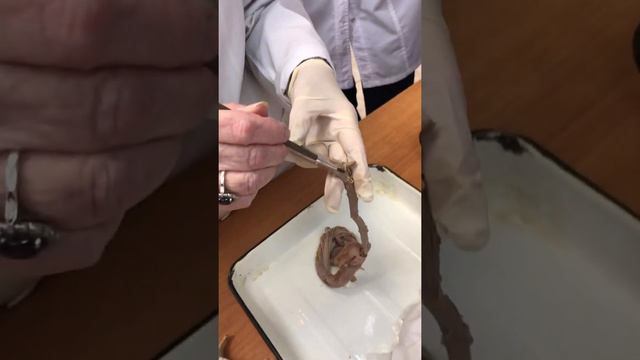 ЦНС. Спинной мозг. Часть 1