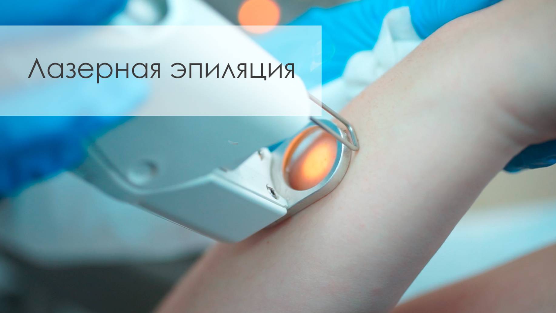 Лазерная эпиляция