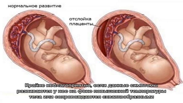 D13d4766f7d85233d77531cf831b0773