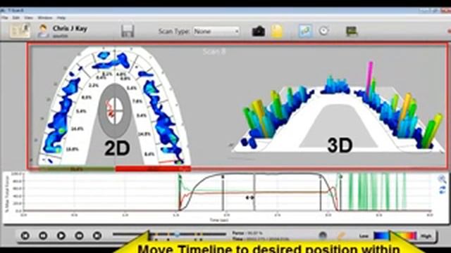T-Scan III: работа с программой T-Scan 8