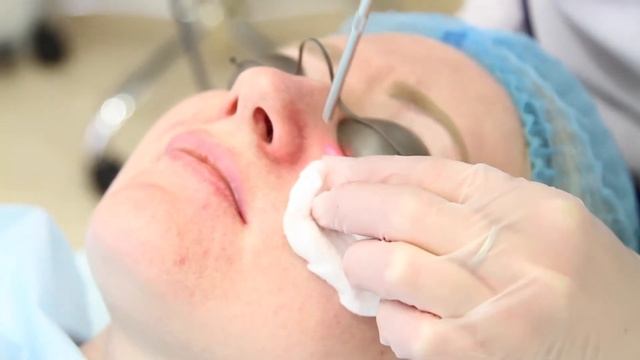 Удаление сосудов на аппарате Fotona в NEO-Clinic