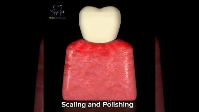 #dental #treatment #pain #bridges #advice #bleeding #braces #canal #cavity #check