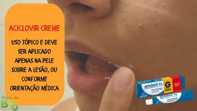 💊 ACICLOVIR POMADA: Para Que Serve? Como Usar? [BULA SIMPLIFICADA]
