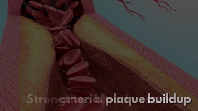 12 Foods To BOOST Legs And Feet CIRCULATION Instantly!