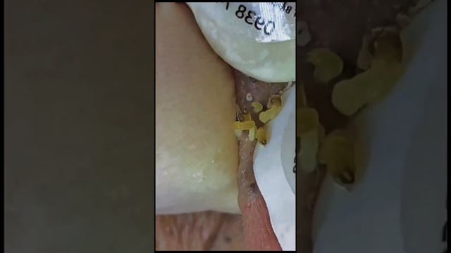 вот как мак добывают