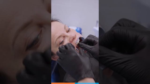 Установка переднего зуба на имплантате / Кейс